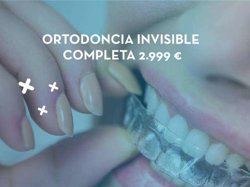 Ortodoncia Invisible en Sevilla