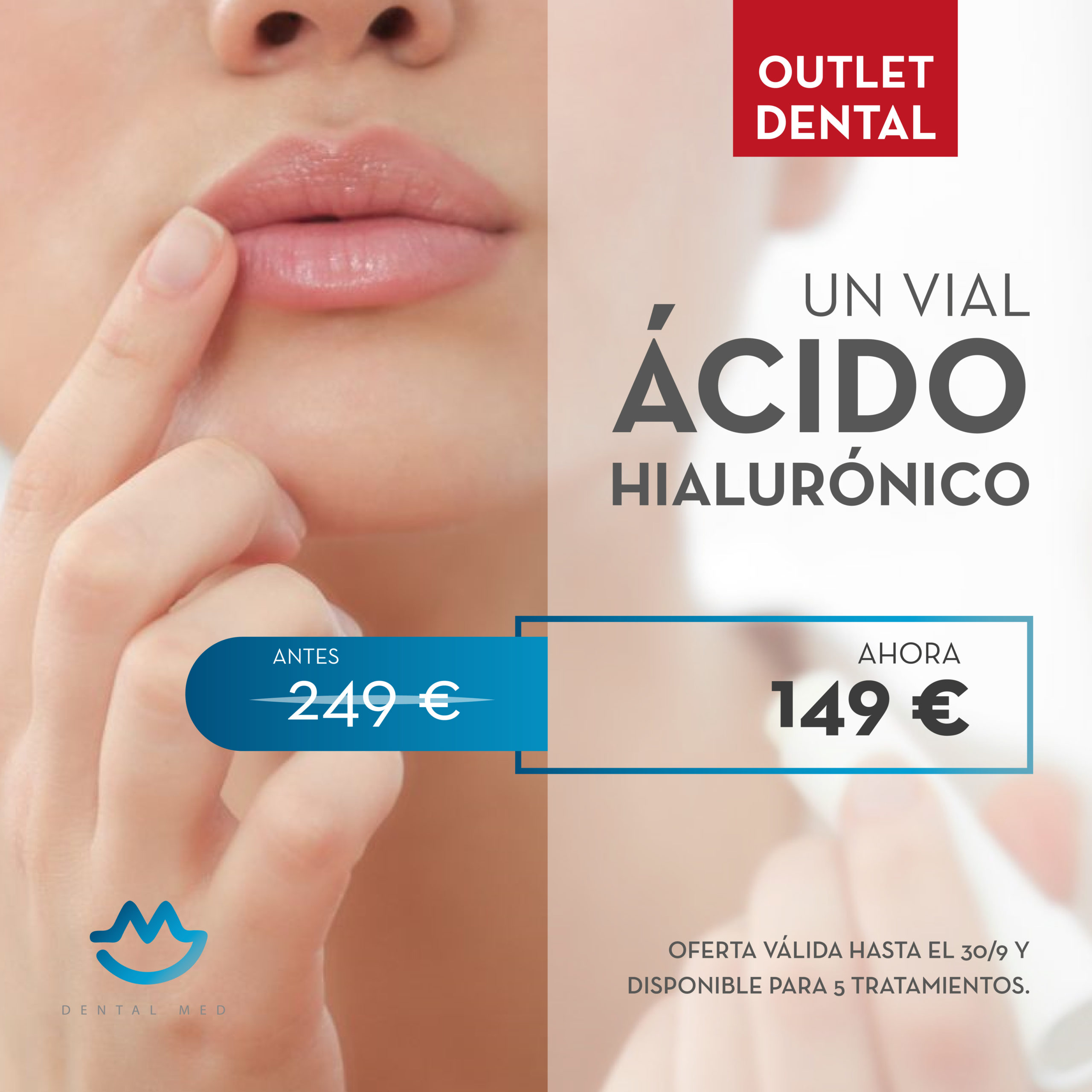 Promoción vial de ácido hialurínico - DentalMed, clínica dental en Sevilla - Clínica dental en Nervión, Sevilla