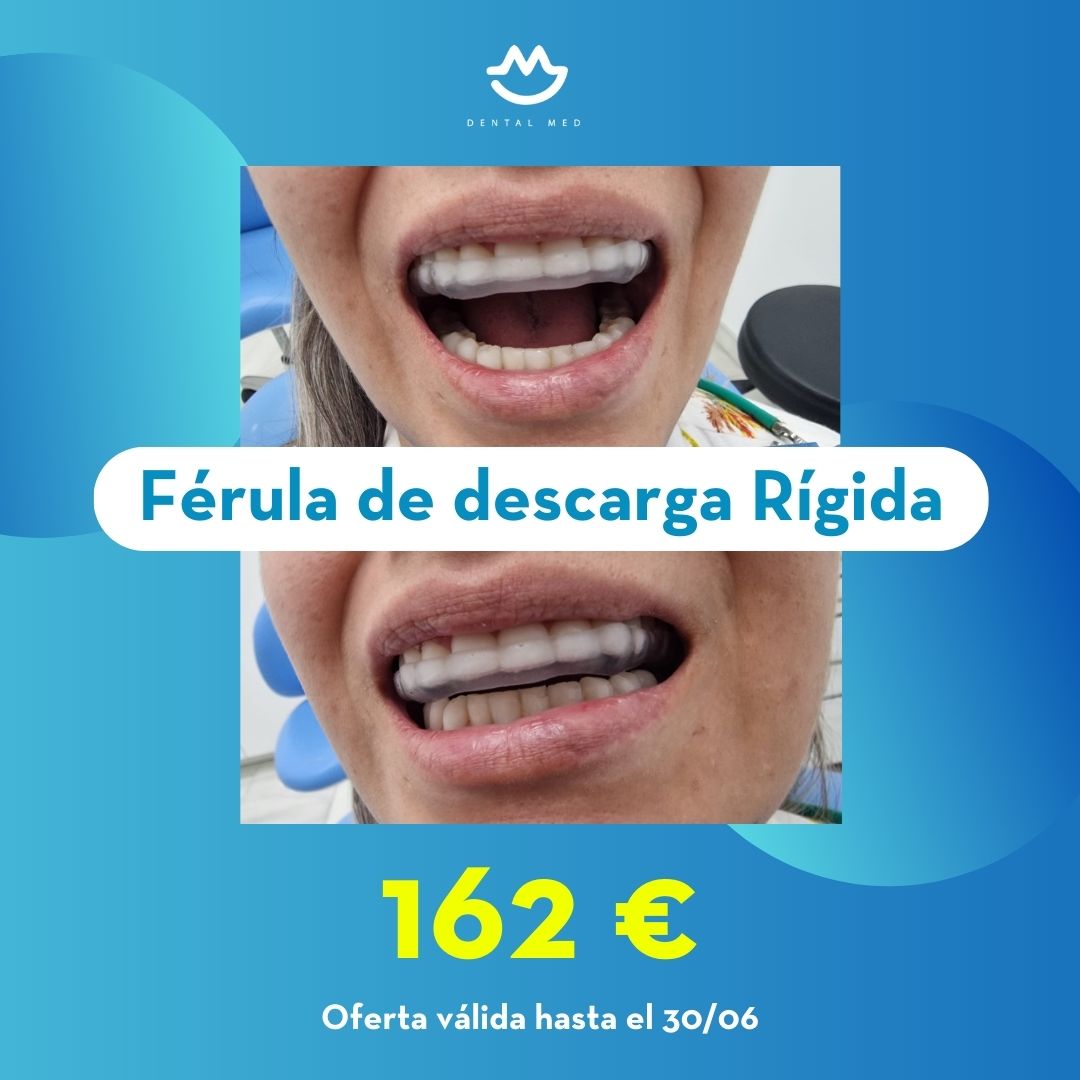 Dental Med - Clínica Dnetal - Férula de Descarga Rígida - Estética Dental - Ortodoncia - Ofertas.