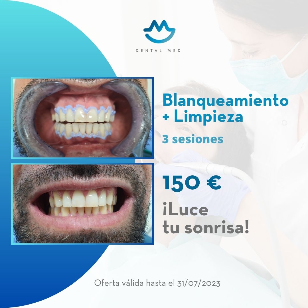 Dental Med, Clínica Dental - Blanqueamiento Dental - Odontología Sevilla - Ortodoncia - Oferta Blanqueamiento Dental Sevilla