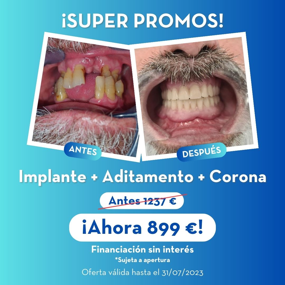 Dental Med, Clínica Dental - Implante - Aditamento - Corona - Odontología Sevilla - Ortodoncia - Oferta Implante - Sevilla