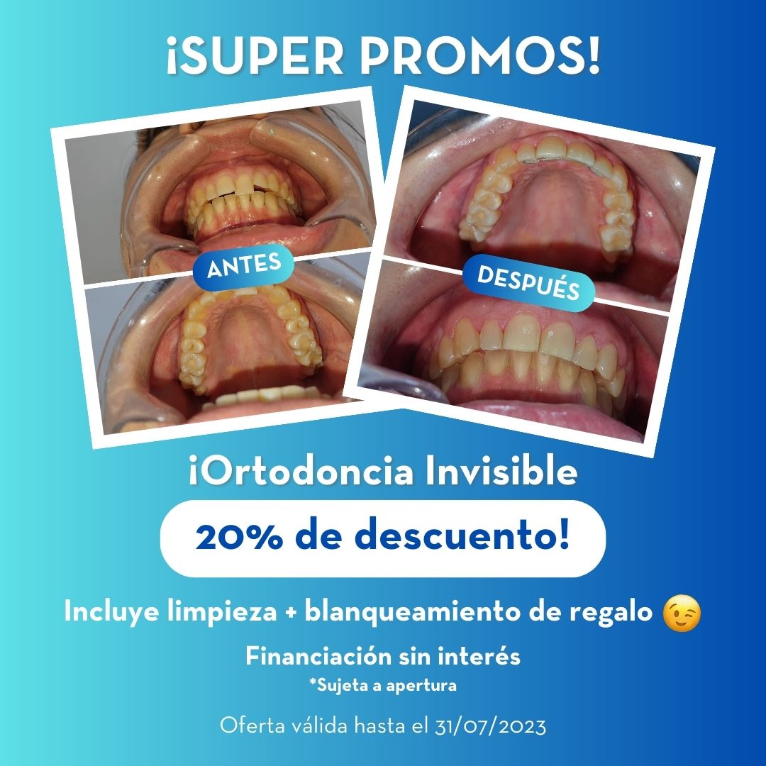 Dental Med, Clínica Dental - Ortodoncia Invisible - Oferta Ortodoncia Invisible -Estética Dental Sevilla
