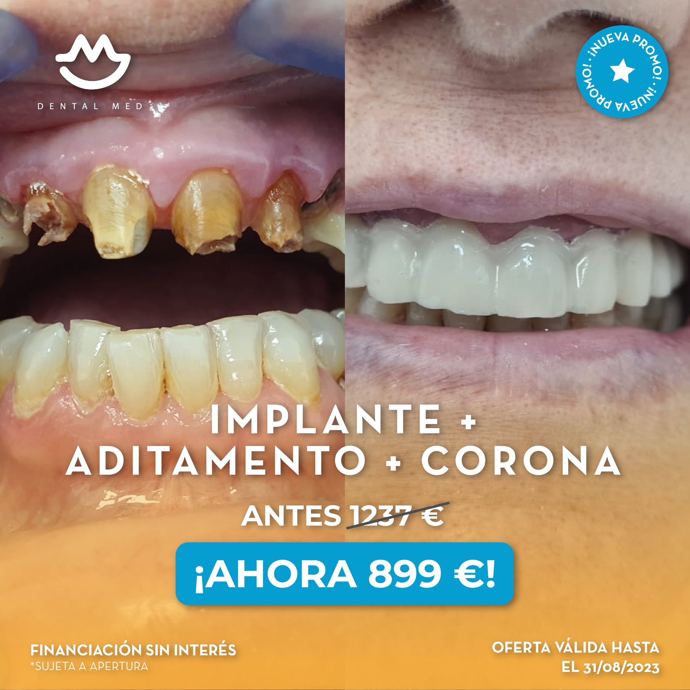 Dental Med, Clínica Dental - Implante - Aditamento - Corona - Odontología Sevilla - Ortodoncia - Oferta Implante - Sevilla