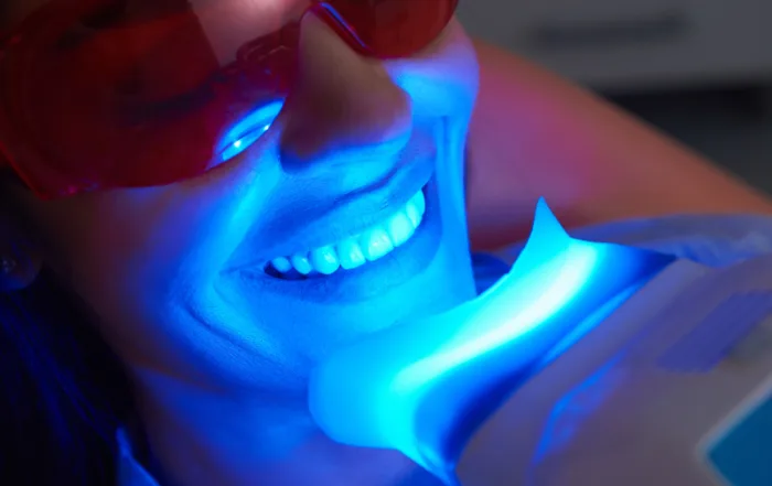 Mitos del blanqueamiento dental