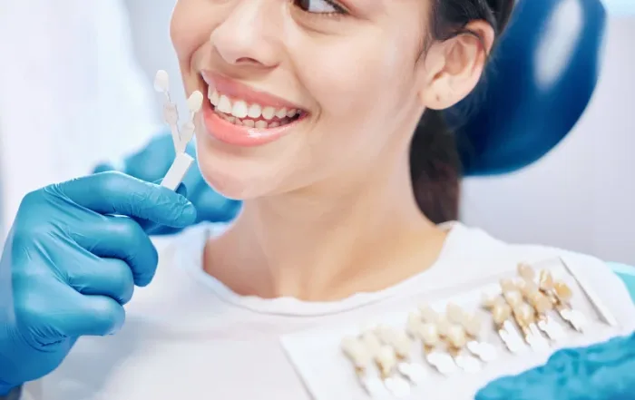 Dental Med Sevilla - Carillas dentales