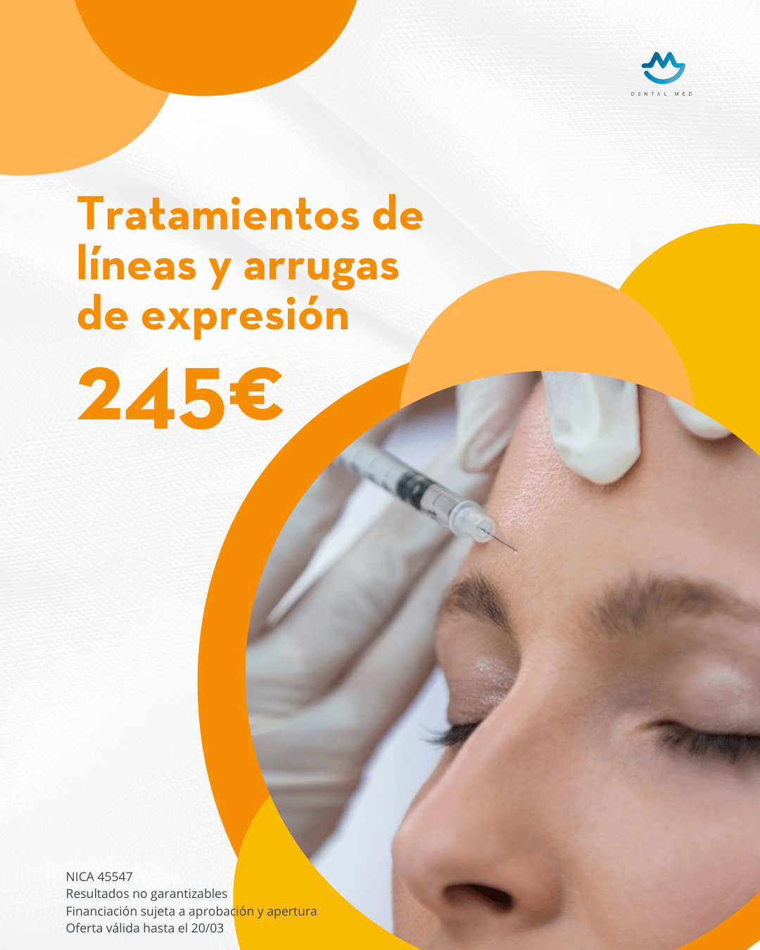 Dental Med Sevilla - Oferta Estética - Tratamientos de líneas de expresión