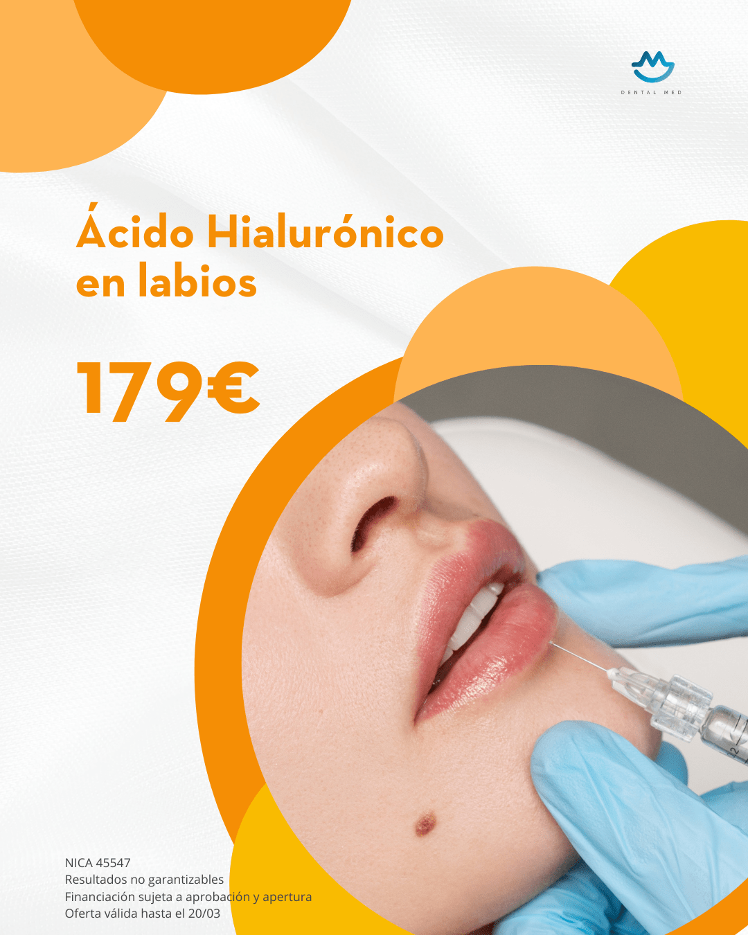 Dental Med Sevilla - Oferta Estética - ácido Hialurónico